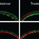 Illustration for article titled Promising Study Shows the Power of Gene Therapy to Treat Deafness